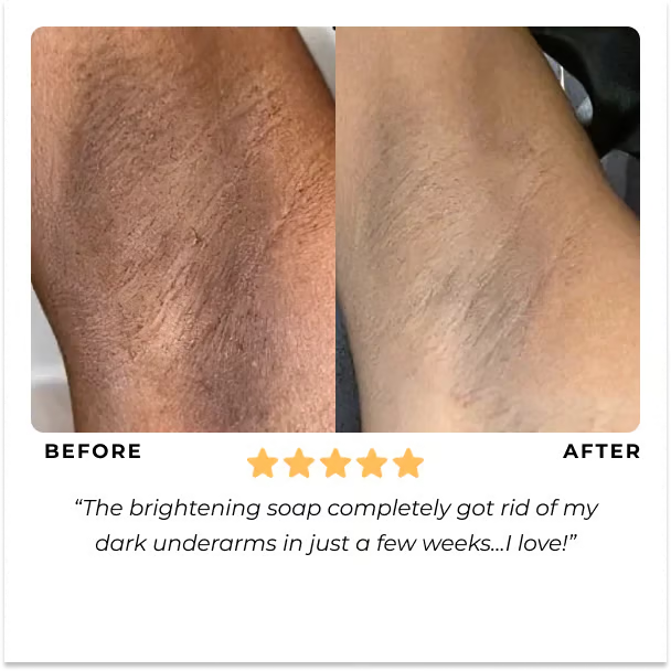 GlowRoot – Radiance Boosting Turmeric Soap