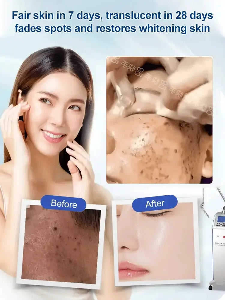 LumiDerm – Gentle Urea Cream