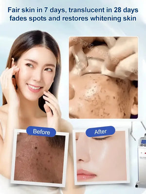 LumiDerm – Gentle Urea Cream