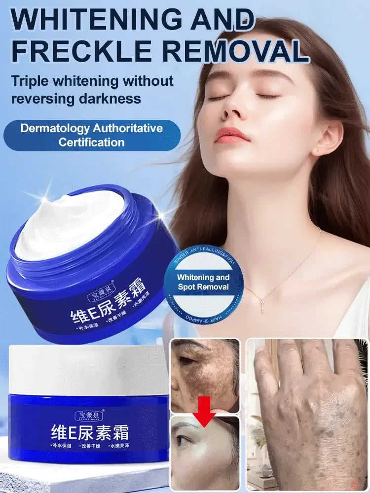 LumiDerm – Gentle Urea Cream