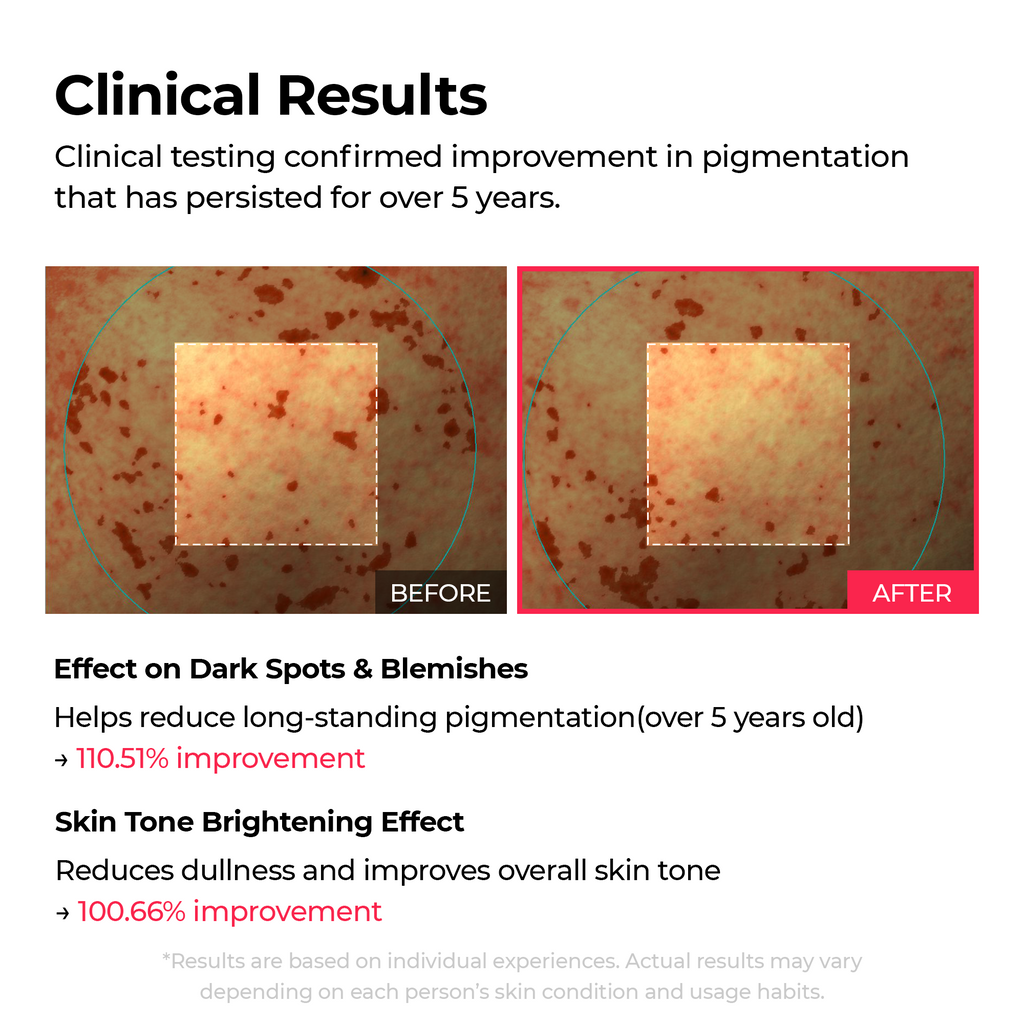 GlowRenew – 🏆 10-Step Dark Spot, Radiance & Firming Skin Renewal Routine Set