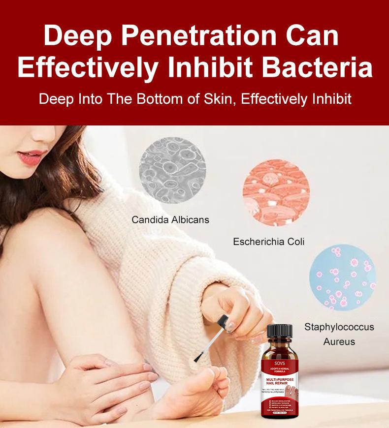 NailRenew – Triple-Action Nail Fungus Treatment for Toenails & Fingernails