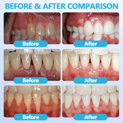 🦷 GumRevive – Gum Repair Gel to Restore & Protect Your Gums