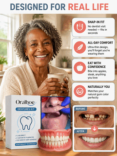 SmileRestore – Natural-Looking Full Dentures You Custom-Fit at Home in Minutes