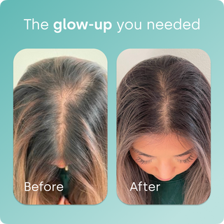 SilicaGlow – Vegan Collagen Generator Liquid Capsules for Skin, Hair & Nails
