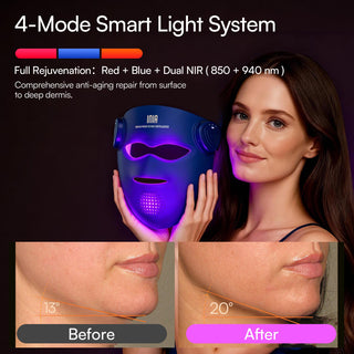 GlowWrap 4D – Dual NIR 940 nm Wireless LED Face Mask