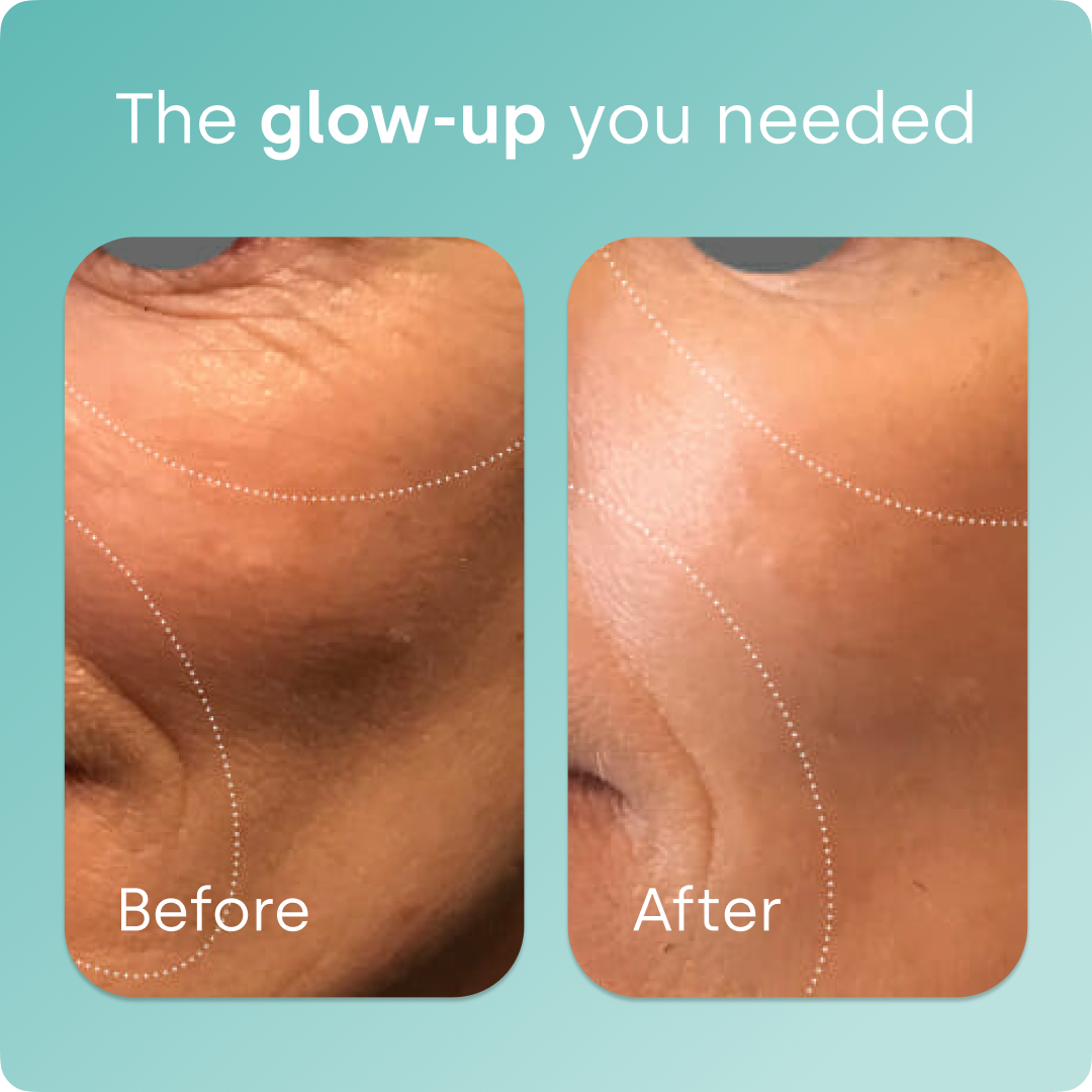 SilicaGlow – Vegan Collagen Generator Liquid Capsules for Skin, Hair & Nails