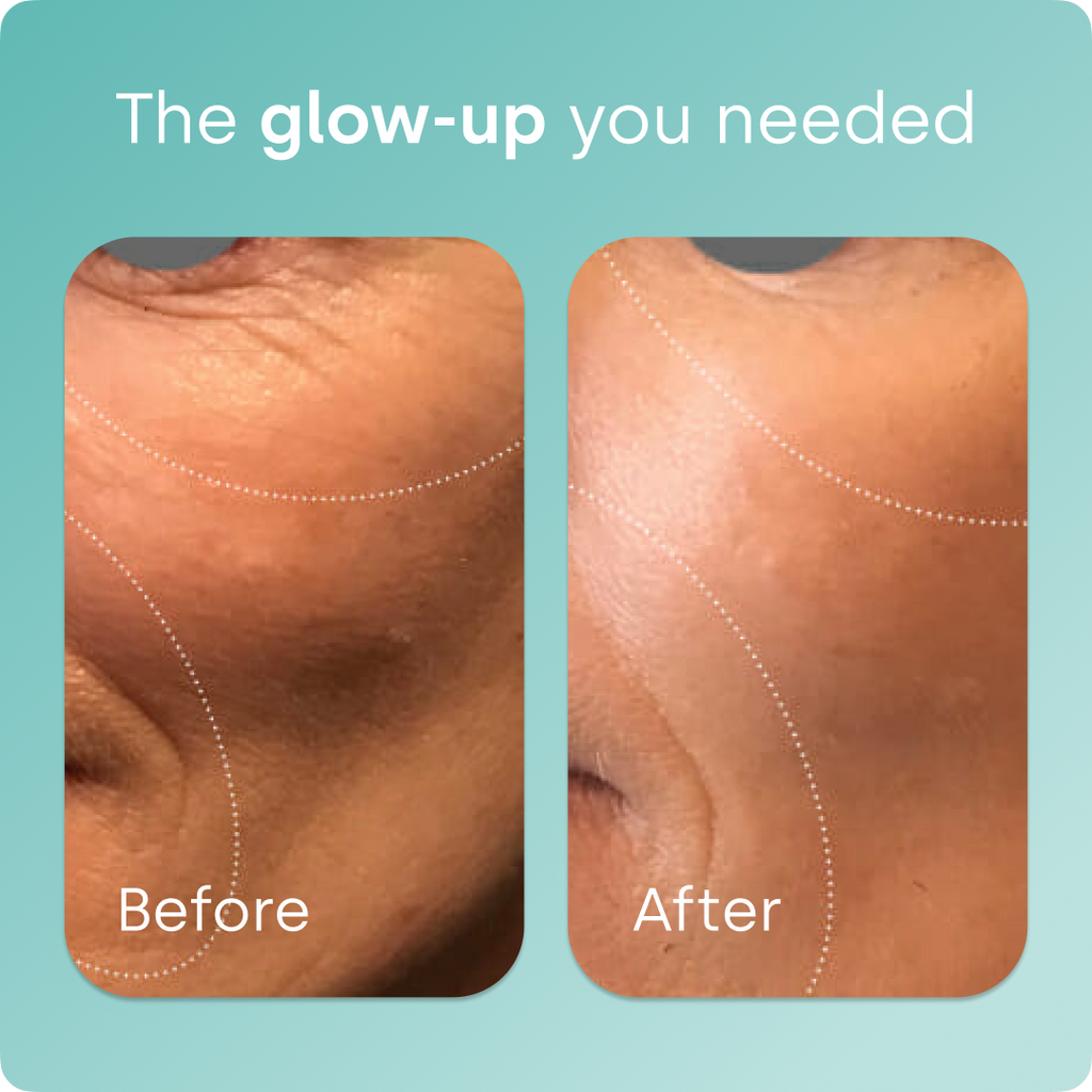 SilicaGlow – Vegan Collagen Generator Liquid Capsules for Skin, Hair & Nails