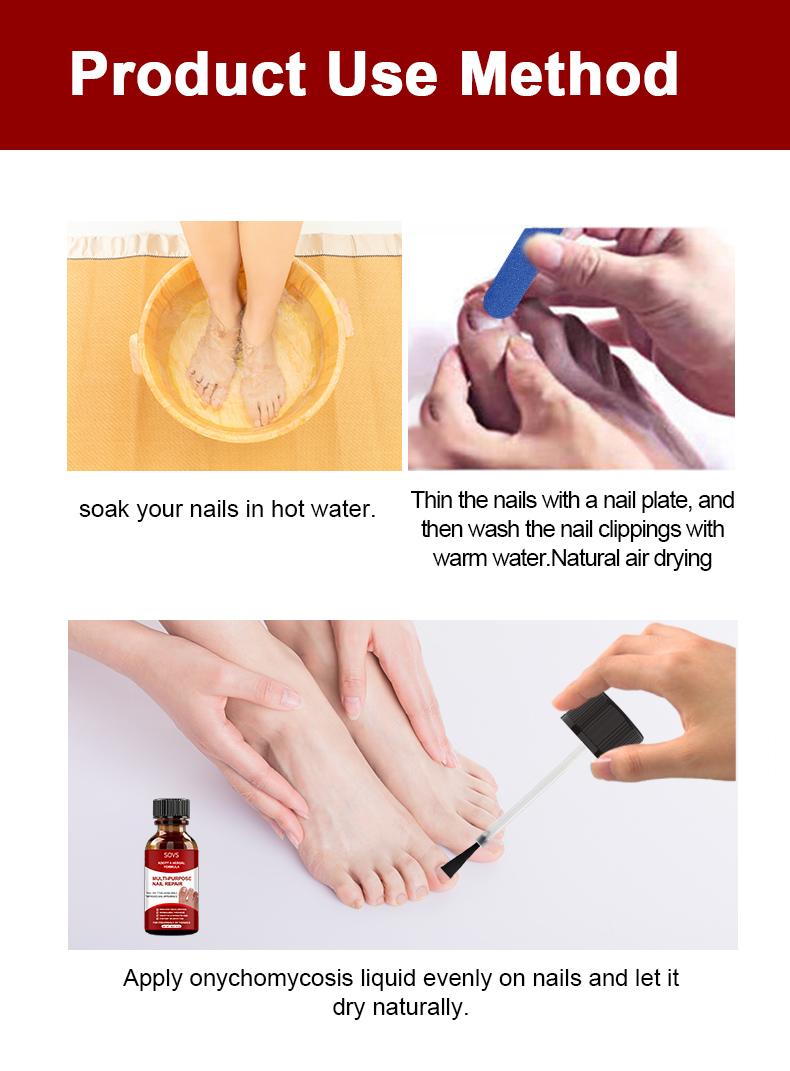 NailRenew – Triple-Action Nail Fungus Treatment for Toenails & Fingernails