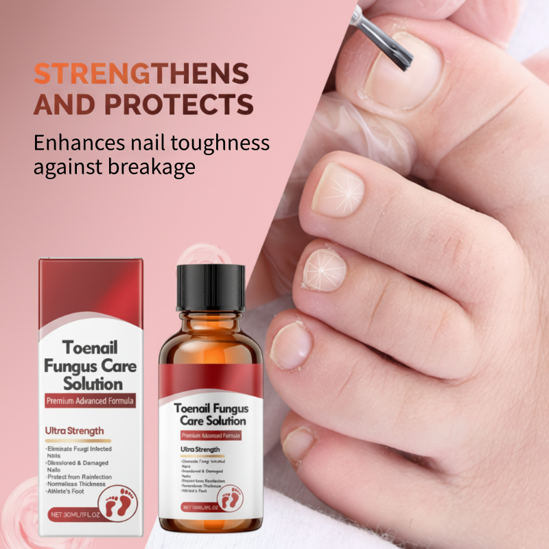 NailRenew – Triple-Action Nail Fungus Treatment for Toenails & Fingernails