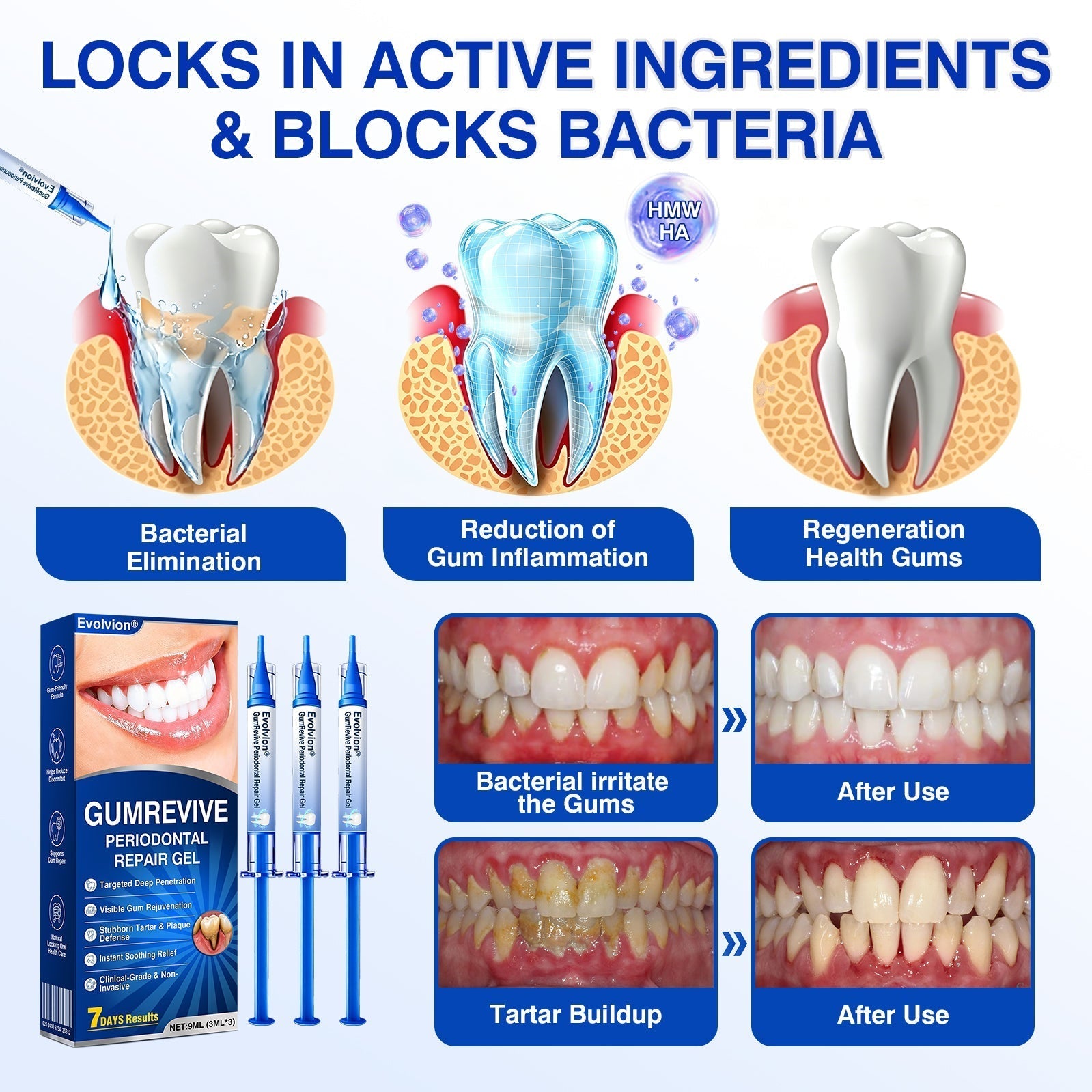 GumRevive – 🇺🇸🏅🦷🛡️ Periodontal Repair Gel
