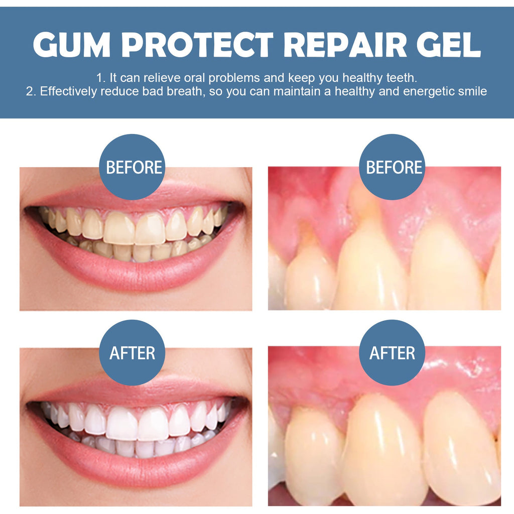 🦷 GumRevive – Gum Repair Gel to Restore & Protect Your Gums
