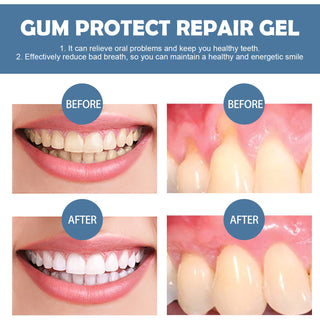🦷 GumRevive – Gum Repair Gel to Restore & Protect Your Gums