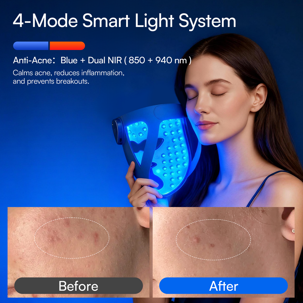 GlowWrap 4D – Dual NIR 940 nm Wireless LED Face Mask