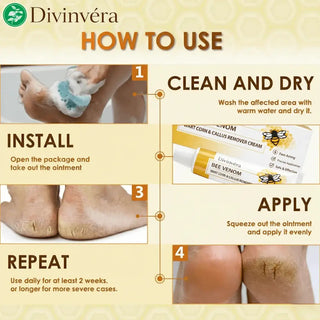 SandalEase – Bee Venom Wart, Corn & Callus Cream