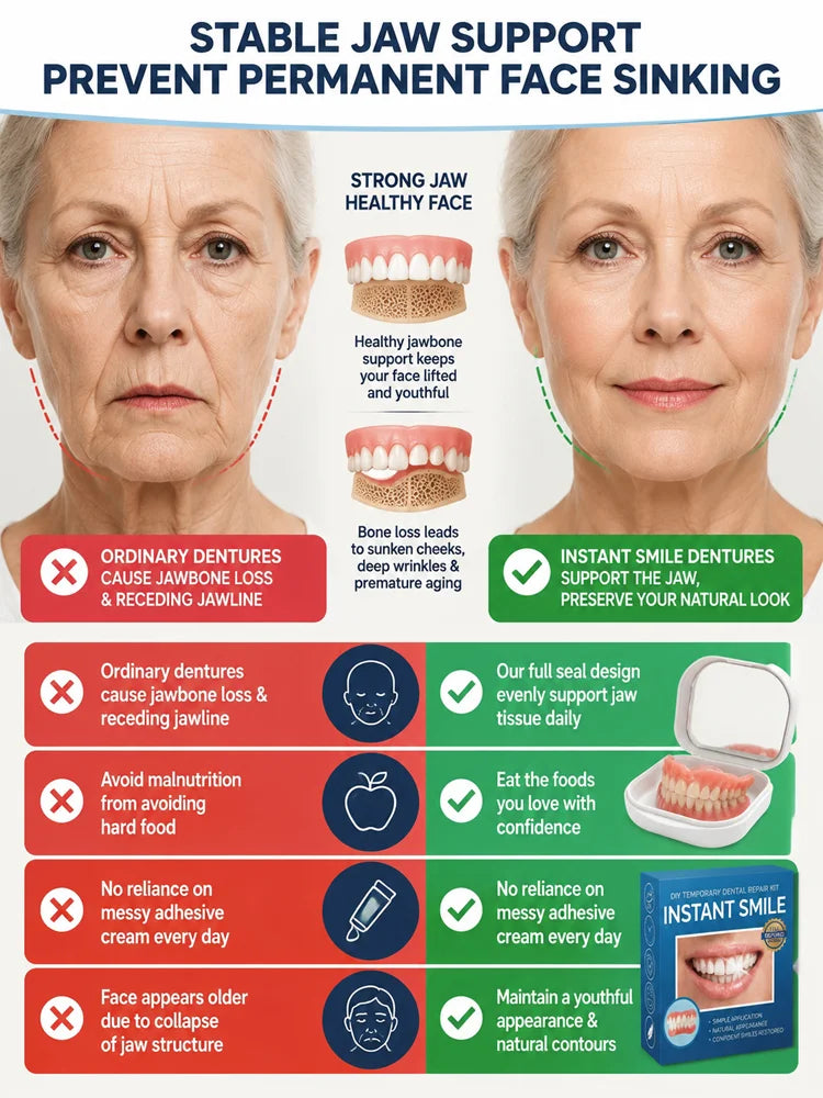 InstantSmile – DIY Temporary Denture Kit with Mirror Storage Case