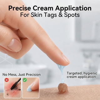 Natravor – 7-Day Skin Tag & Spot Eraser Cream