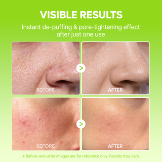 GlowRenew – 🏆 10-Step Dark Spot, Radiance & Firming Skin Renewal Routine Set