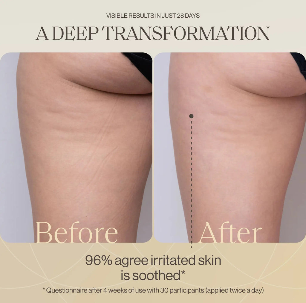 LymphaSculpt – Shaping Body Cream With LYMPHACTIVE™