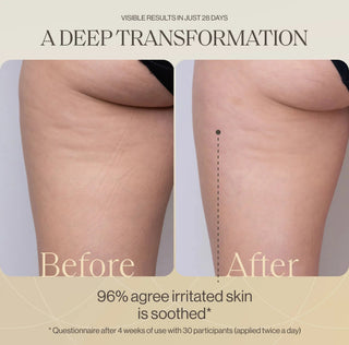 LymphaSculpt – Shaping Body Cream With LYMPHACTIVE™