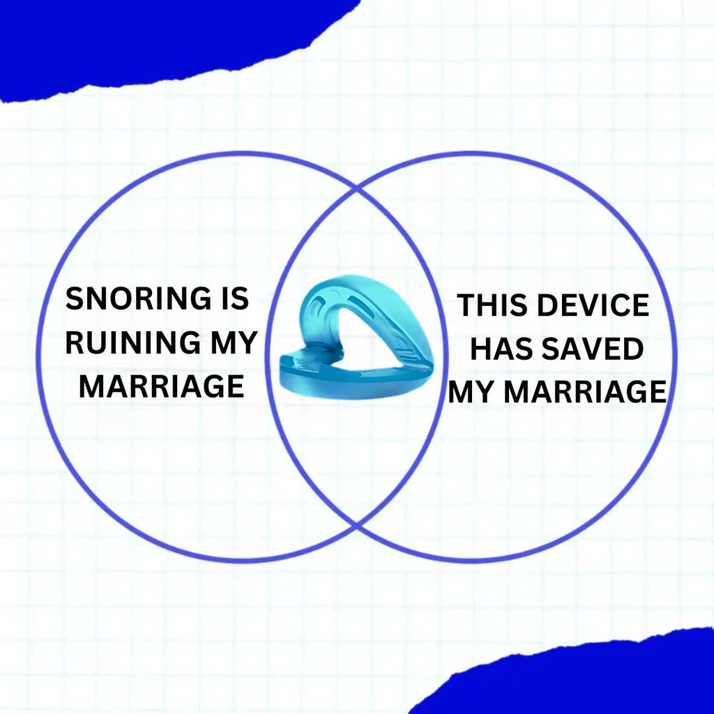 SoniRest – Universal Anti-Snoring Mouthpiece