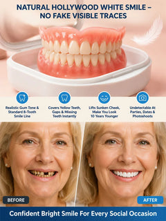 InstantSmile – DIY Temporary Denture Kit with Mirror Storage Case
