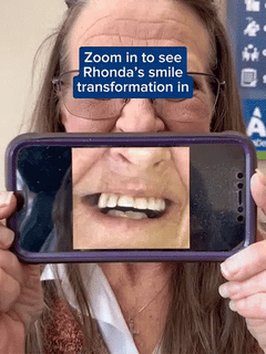 InstantSmile – DIY Temporary Denture Kit with Mirror Storage Case