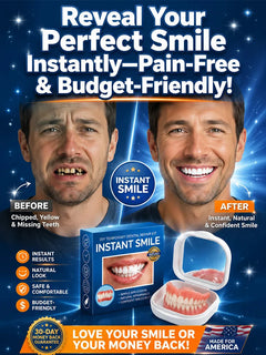 InstantSmile – DIY Temporary Denture Kit with Mirror Storage Case