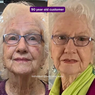 Before and after of a 90 year old customer showing smoother skin after using the Equinox Pro LED mask