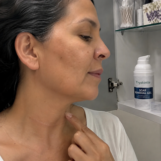 ScarCalm – Medical-Grade Silicone Scar Gel