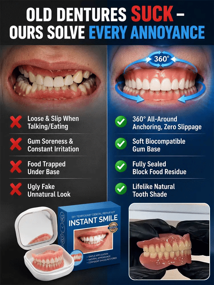 InstantSmile – DIY Temporary Denture Kit with Mirror Storage Case