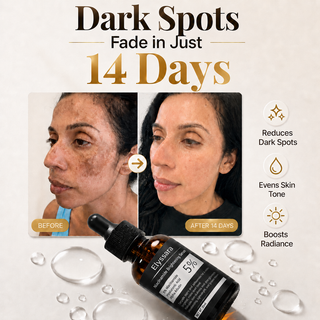 SpotFade – 5% Niacinamide + Alpha Arbutin Dark Spot Serum