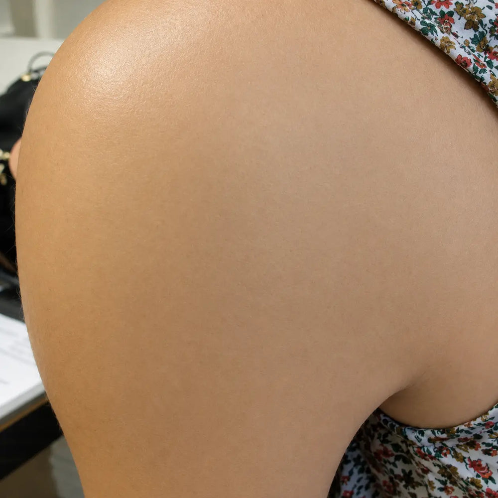 ScarCalm – Medical-Grade Silicone Scar Gel