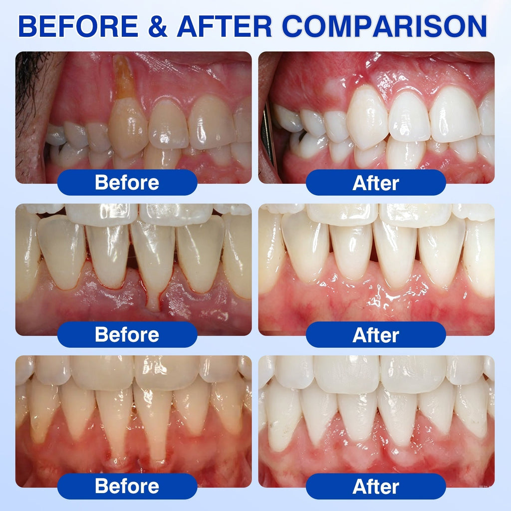GumRevive – 🇺🇸🏅🦷🛡️ Periodontal Repair Gel