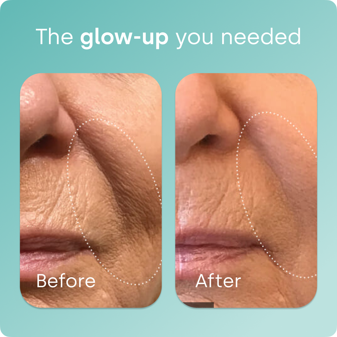 SilicaGlow – Vegan Collagen Generator Liquid Capsules for Skin, Hair & Nails