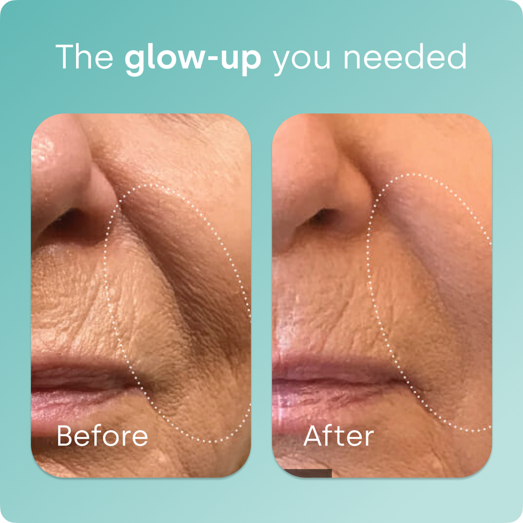 SilicaGlow – Vegan Collagen Generator Liquid Capsules for Skin, Hair & Nails