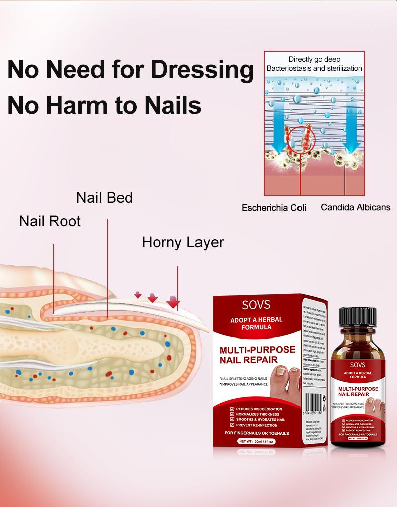 NailRenew – Triple-Action Nail Fungus Treatment for Toenails & Fingernails