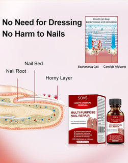 NailRenew – Triple-Action Nail Fungus Treatment for Toenails & Fingernails