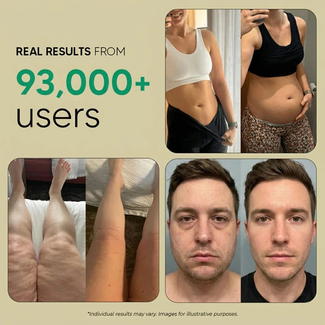 LymphaFlow – Maximum Potency Lymphatic Drainage Capsules by Sculptique™