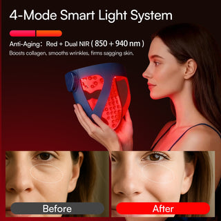 GlowWrap 4D – Dual NIR 940 nm Wireless LED Face Mask