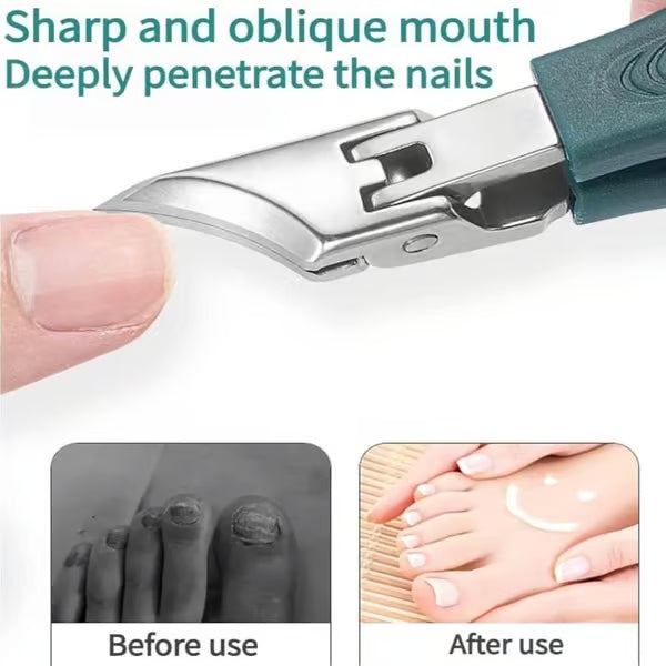 BeakTrim – Three-Piece Beak-Shaped Nail Clipper Set with Ergonomic Design