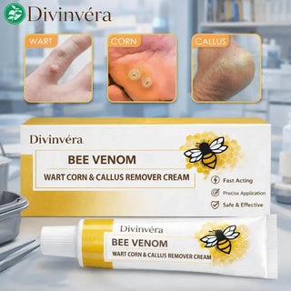 SandalEase – Bee Venom Wart, Corn & Callus Cream