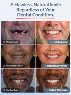 SmileRestore – Natural-Looking Full Dentures You Custom-Fit at Home in Minutes