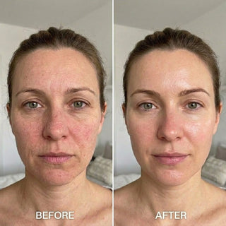 SilkGlow – EGF Peptide Firming Toner