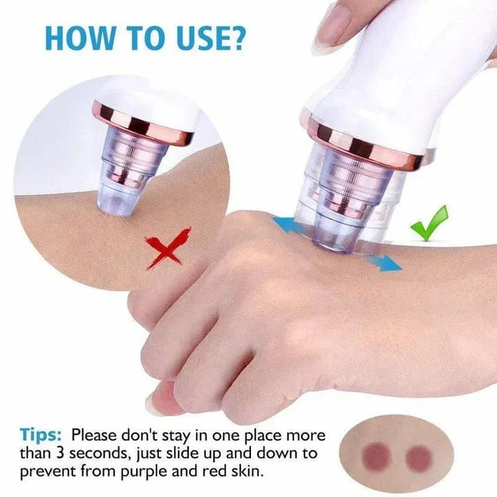 PoreGlide – Adjustable Blackhead Removal & Pore Cleaner