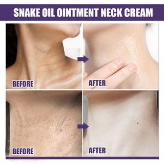 SkinLift – Hydrating & Smoothing Neck-Firming Cream