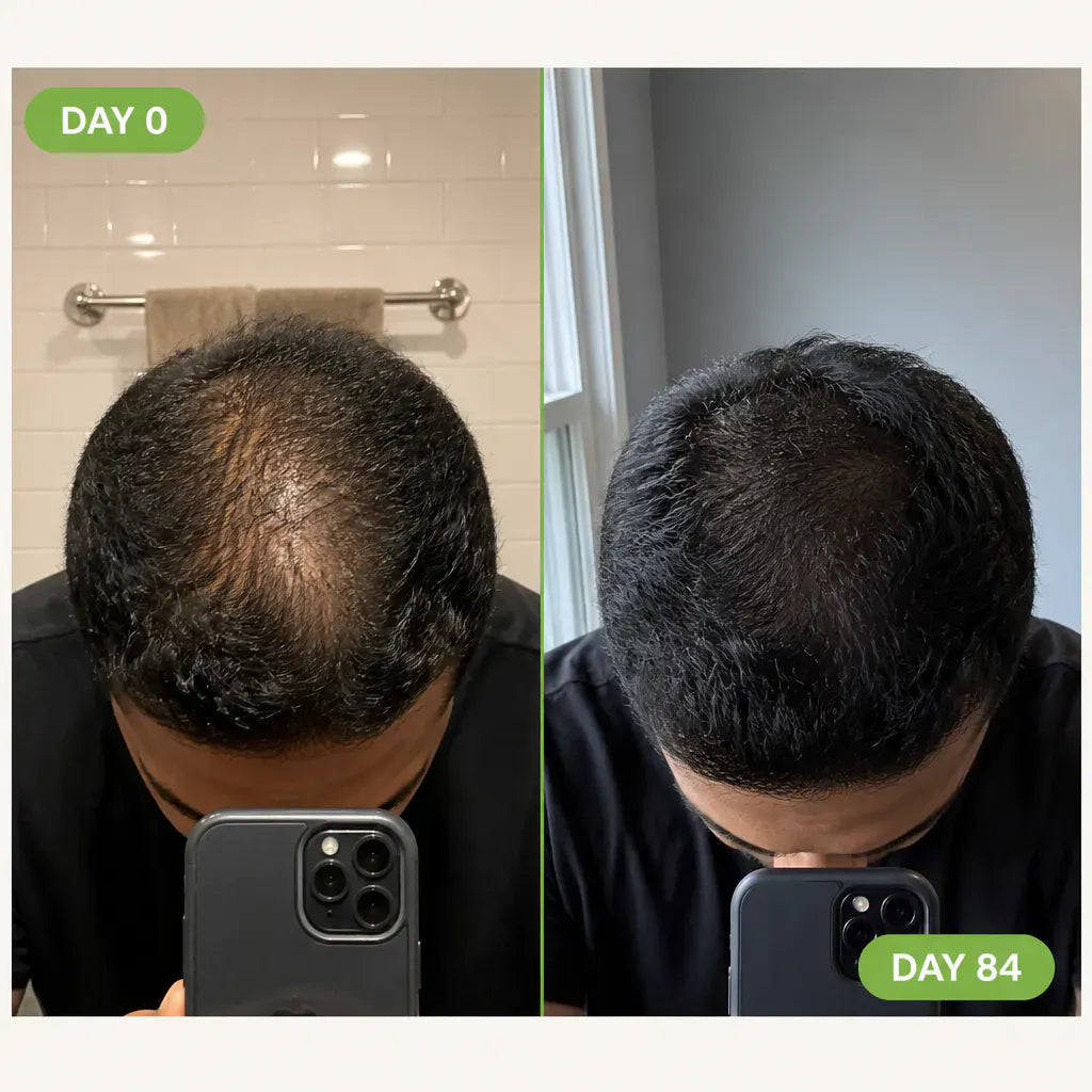 ScalpRevive – Herbal Men's Scalp Care Shampoo Bar