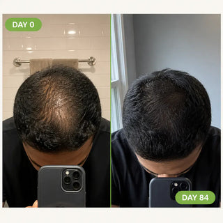 ScalpRevive – Herbal Men's Scalp Care Shampoo Bar