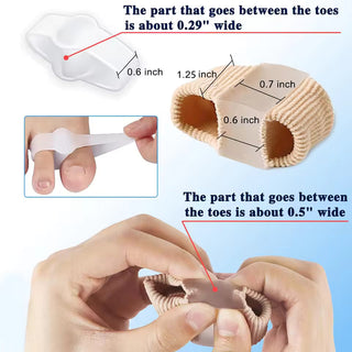 ToeAlign – Bunion Corrector System