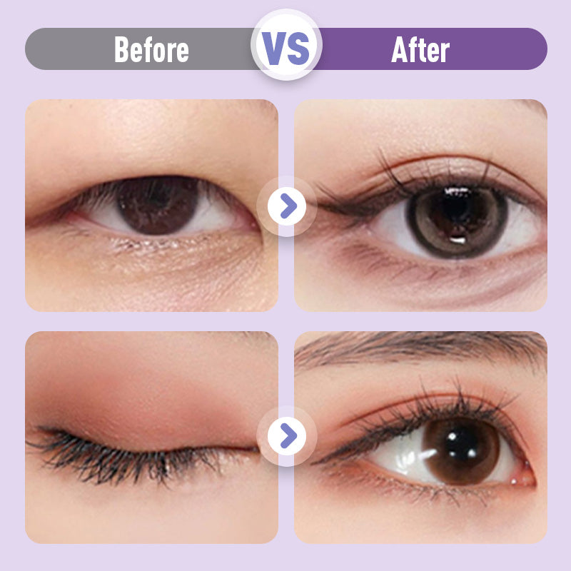 BeautyFold - Natural Look Eyelid Cream